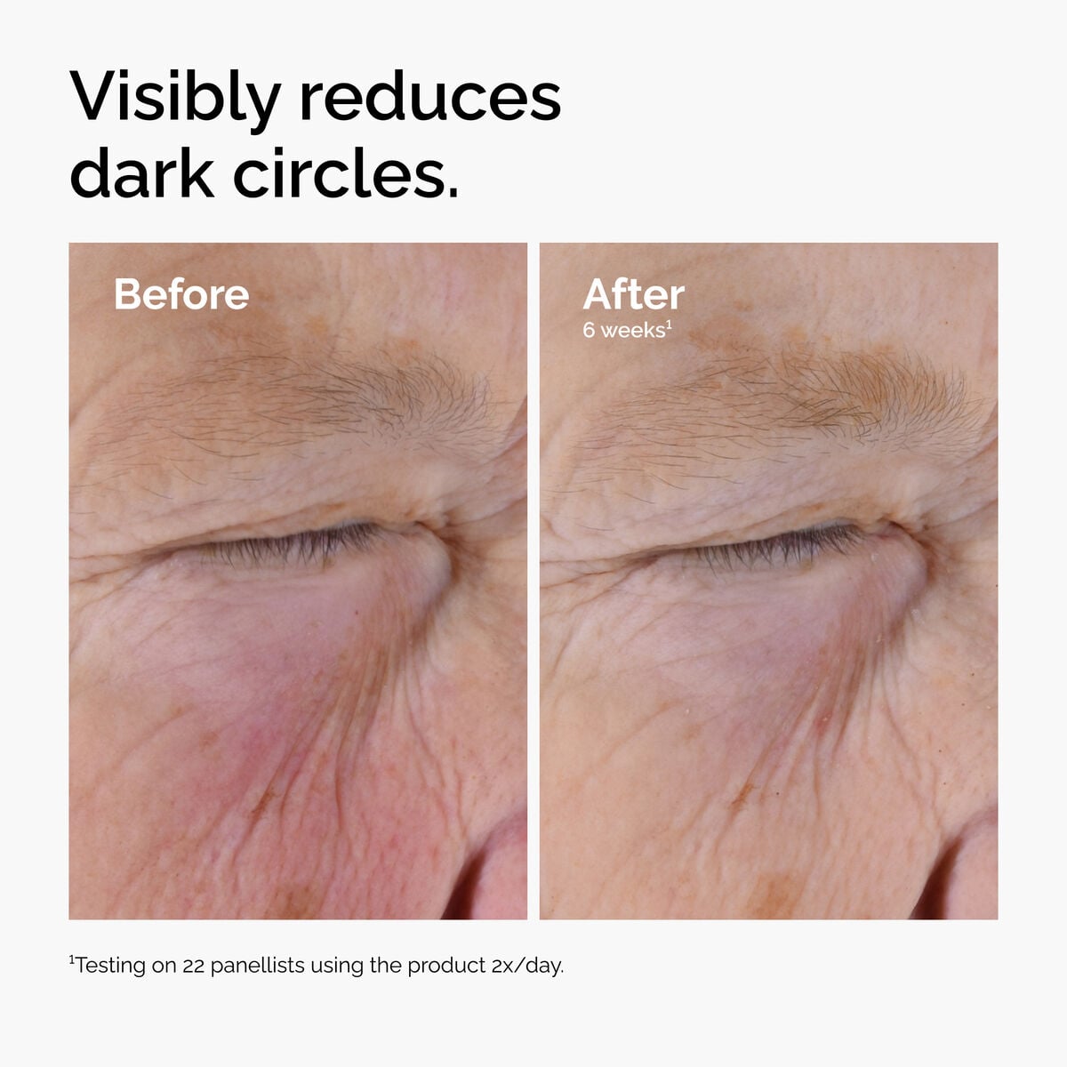 caffeine-solution-5-egcg-eye-serum-r4 ord-caffeine-solution-egcg-dark-circles-before-after.jpg