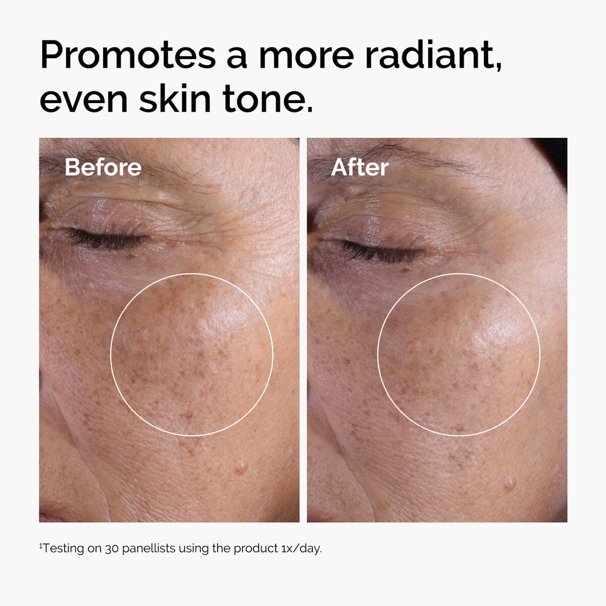 glycolic-acid-7-exfoliating-toner-b1 ord-glycolic-before-after-radiance.jpg