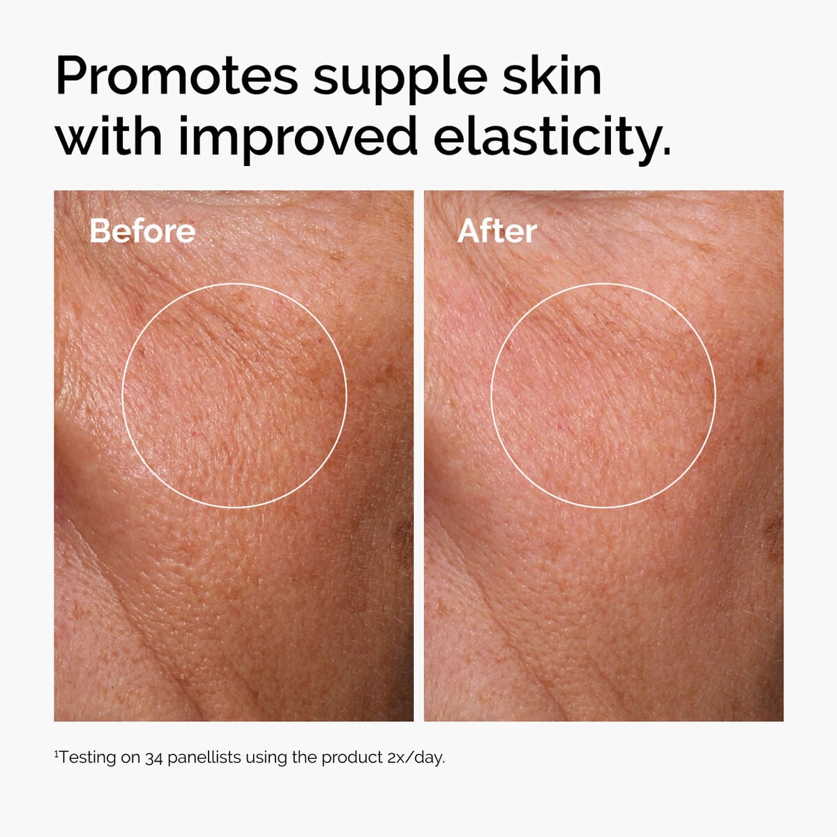 hyaluronic-acid-2-b5-with-ceramides-o8 ord-hyaluronic-acid-2pct-b5-hydrating-serum-before-after-elasticity.jpg