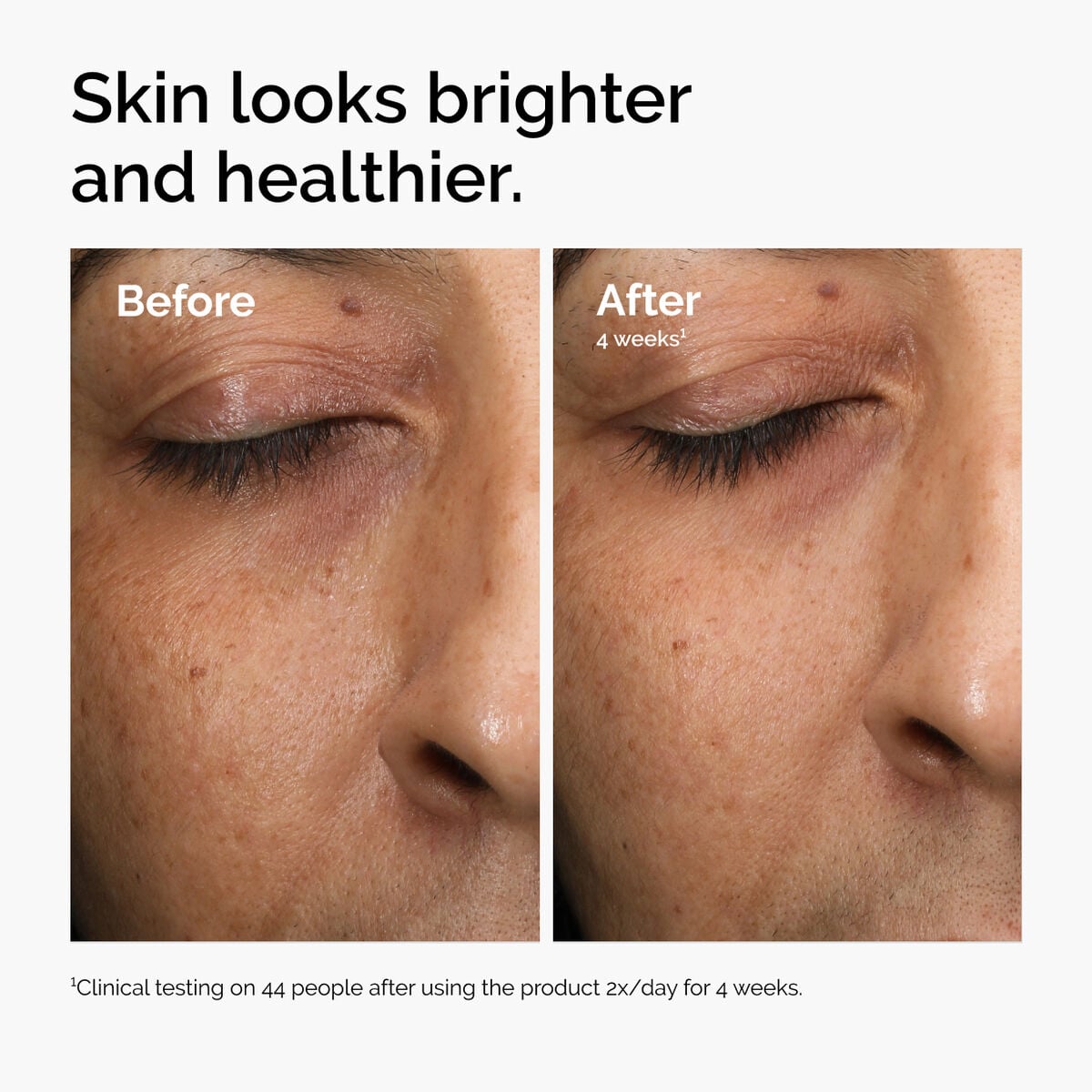 multi-antioxidant-radiance-serum-s9 ord-mars-before-after-healthy.jpg