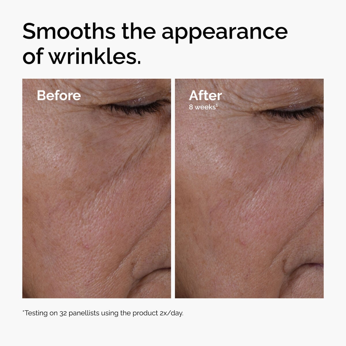 multi-peptide-ha-serum-o9 ord-multi-peptide-ha-serum-wrinkles-before-after.jpg