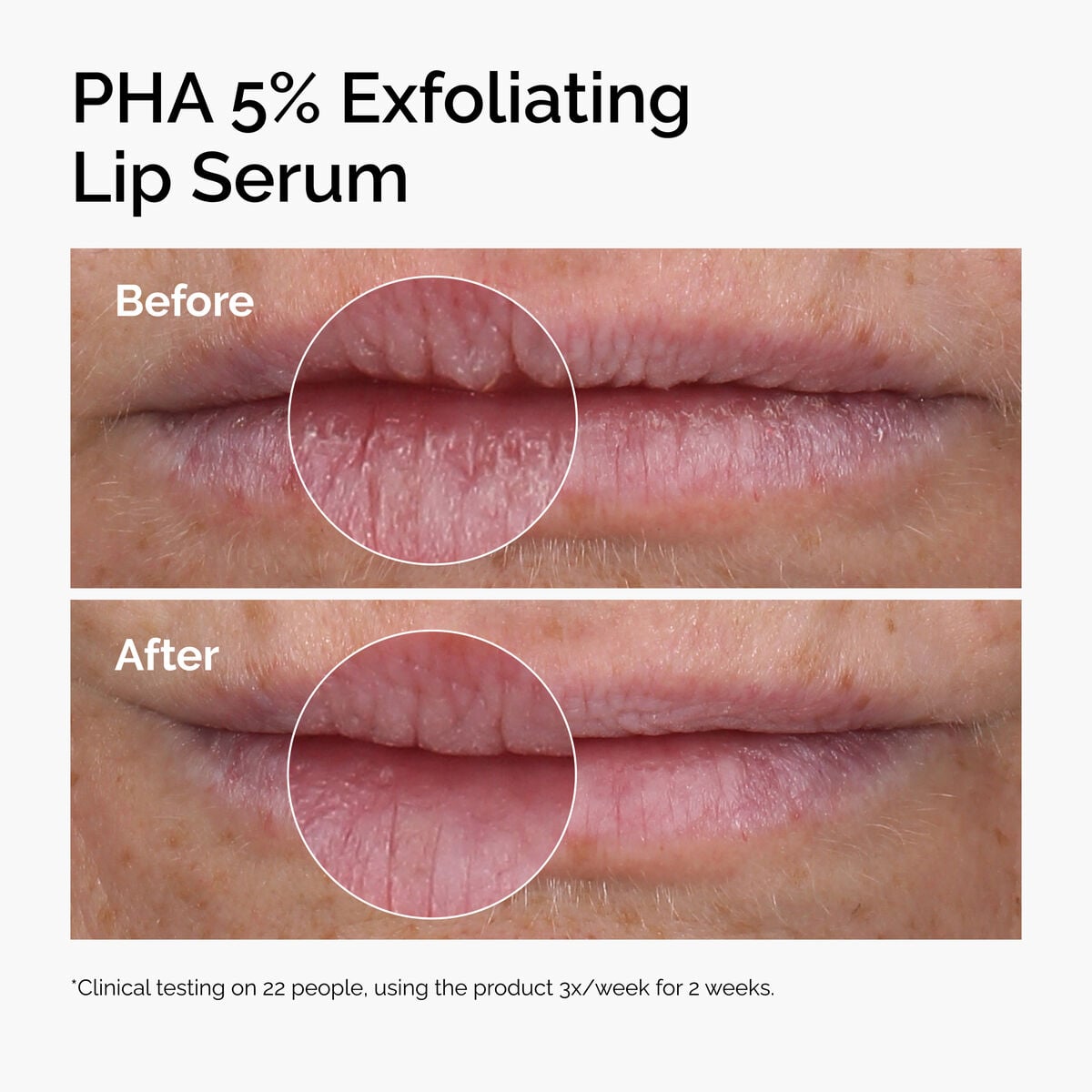 pha-5-exfoliating-lip-serum-k9 ord-pha-5pct-lip-exfoliating-serum-before-after.jpg