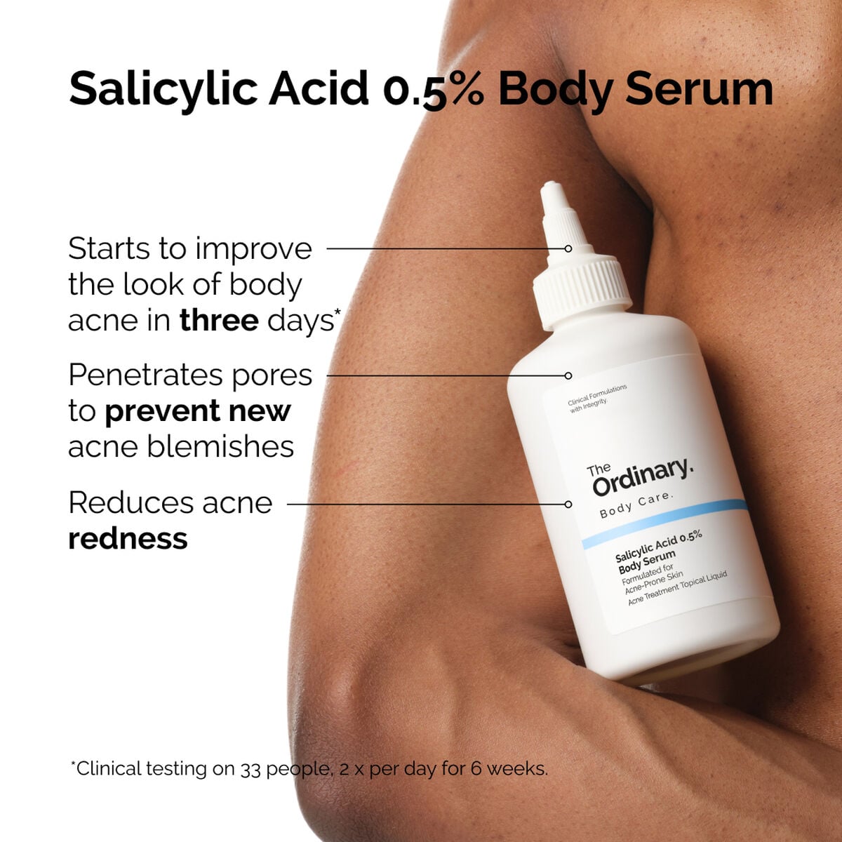 salicylic-acid-0-5-body-serum-q0 ord-salicylic-05-body-serum-otc-benefits-infographic.jpg
